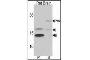 Western blot analysis of LC3B Antibody  in Rat brain lysate.