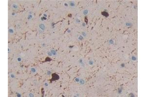 Detection of CR in Human Brain Tissue using Polyclonal Antibody to Calretinin (CR) (Calretinin anticorps  (AA 28-248))