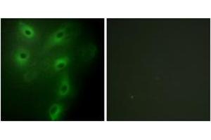 Immunofluorescence analysis of HeLa cells, using TRIM59 Antibody. (TRIM59 anticorps  (AA 191-240))