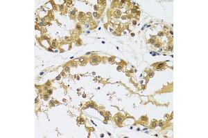 Immunohistochemistry of paraffin-embedded human breast using RPS12 antibody.