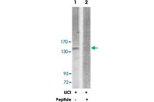 Western blot analysis of extracts from 293 cells, treated with LiCl (0. (ERBB3 anticorps)