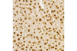 Immunohistochemistry of paraffin-embedded human breast using H4K8ac antibody (ABIN7267747) at dilution of 1:100 (40x lens).