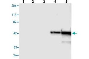 Western blot analysis of Lane 1: RT-4, Lane 2: U-251 MG, Lane 3: A-431, Lane 4: Liver, Lane 5: Tonsil with FGB polyclonal antibody . (Fibrinogen beta Chain anticorps)