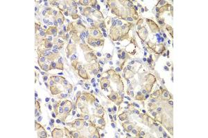 Immunohistochemistry of paraffin-embedded human stomach using Lyn antibody (ABIN5998158) at dilution of 1/100 (40x lens). (LYN anticorps)