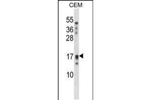 Western blot analysis in CEM cell line lysates (35ug/lane). (Kallikrein 15 anticorps  (AA 78-106))