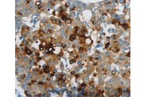 Immunohistochemistry (IHC) image for anti-Lipocalin 2 (LCN2) (AA 1-100) antibody (ABIN3017526)