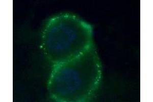 Expression of Zinc-activated channel in human PANC-1 cells - Cell surface detection of Zinc-activated channel in human intact living pancreatic adenocarcinoma (PANC-1) cells.