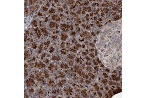 Immunohistochemical staining of human pancreas with NUDT22 polyclonal antibody  shows strong cytoplasmic positivity in exocrine glandular cells at 1:20-1:50 dilution. (NUDT22 anticorps)