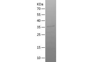 Western Blotting (WB) image for Synaptopodin 2-Like (SYNPO2L) (AA 181-465) protein (His tag) (ABIN7125271)