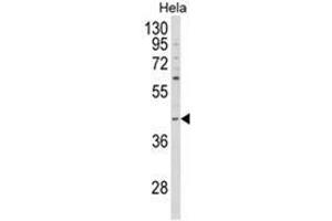 Western blot analysis of NCK1 Antibody (N-term) in Hela cell line lysates (35ug/lane). (NCK1 anticorps  (N-Term))