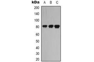 Western blot analysis of LRRC41 expression in K562 (A), rat kidney (B), rat heart (C) whole cell lysates.