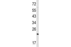 Western blot analysis of RAN antibody and HL-60 lysate.