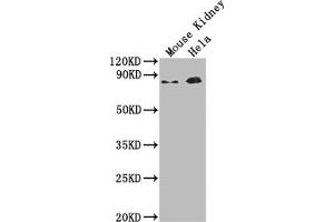 Western Blot Positive WB detected in: Mouse Kidney tissue, Hela whole cell lysate All lanes: Ripk1 antibody at 1:2000 Secondary Goat polyclonal to rabbit IgG at 1/50000 dilution Predicted band size: 75 kDa Observed band size: 75 kDa (RIPK1 anticorps  (AA 1-656))