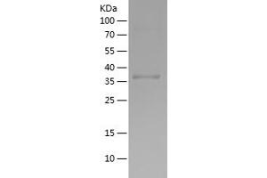 Western Blotting (WB) image for Growth Differentiation Factor 2 (GDF2) (AA 320-429) protein (His-IF2DI Tag) (ABIN7123208)