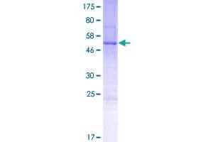 Image no. 1 for Maestro (MRO) (AA 1-248) protein (GST tag) (ABIN1311282)