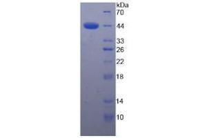 SDS-PAGE analysis of Human Complement Factor H Protein. (Complement Factor H Protein (CFH))