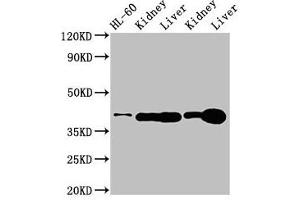 Western Blot Positive WB detected in: HL60 whole cell lysate, Rat kidney tissue, Rat liver tissue, Mouse kideny tissue, Mouse liver tissue All lanes: ADK antibody at 3 μg/mL Secondary Goat polyclonal to rabbit IgG at 1/50000 dilution Predicted band size: 41, 39, 35, 37 kDa Observed band size: 41 kDa (ADK anticorps  (AA 18-256))