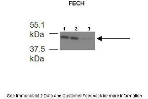 Lanes:   1. (FECH anticorps  (Middle Region))
