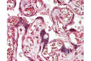 Human Placenta: Formalin-Fixed, Paraffin-Embedded (FFPE) (ADAM19 anticorps)