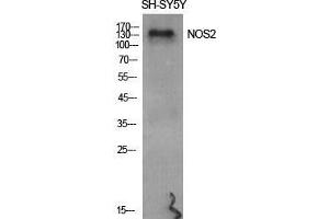 Western Blot (WB) analysis of specific cells using NOS2 Polyclonal Antibody. (NOS2 anticorps  (Thr177))