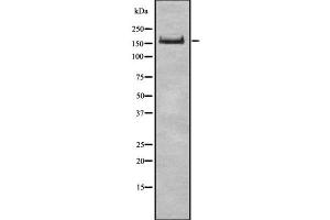 Western blot analysis UGGT1 using COLO205 whole cell lysates