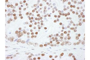 anti-Heterogeneous Nuclear Ribonucleoprotein L (HNRNPL) (AA 350-400) antibody