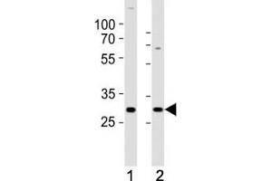 Western blot analysis of lysate from (1) SH-SY5Y and (2) MCF-7 cell line using HES1 antibody at 1:1000.