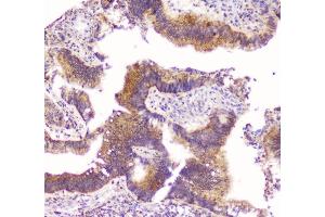 IHC analysis of TNFRSF11B using anti-TNFRSF11B antibody (ABIN7600875).