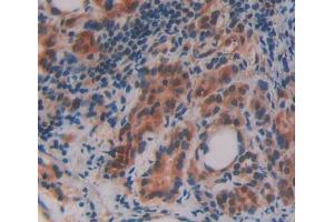 Used in DAB staining on fromalin fixed paraffin- embedded thyroid tissue (OSBP anticorps  (AA 546-807))