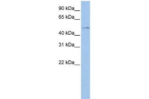 WB Suggested Anti-TSPYL4 Antibody Titration: 0. (TSPY-Like 4 anticorps  (Middle Region))