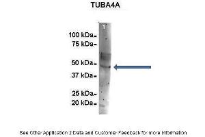 Amount and Sample Type :  500 ug mouse brain homogenate  Amount of IP Antibody :  6 ug  Primary Antibody :  TUBA4A  Primary Antibody Dilution :  1:500  Secondary Antibody :  Goat anti-rabbit Alexa-Fluor 594  Secondary Antibody Dilution :  1:5000  Gene Name :  TUBA4A  Submitted by :  Dr.