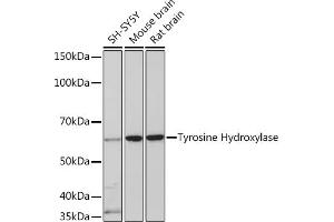 Western blot analysis of extracts of various cell lines, using Tyrosine Hydroxylase Rabbit mAb (ABIN1682210, ABIN3019364, ABIN3019365 and ABIN7101758) at 1:1000 dilution. (PNPT1 anticorps)
