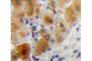 Used in DAB staining on fromalin fixed paraffin-embedded Liver tissue (PLA2G7 anticorps  (AA 22-441))
