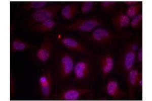 Image no. 1 for anti-Myc Proto-Oncogene protein (MYC) (pThr358) antibody (ABIN196675) (c-MYC anticorps  (pThr358))