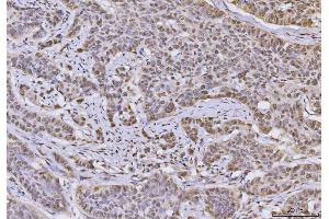 IHC analysis of hnRNP U/p120/HNRNPU using anti-hnRNP U/p120/HNRNPU antibody (ABIN7600979).