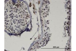 Image no. 1 for anti-LIM Homeobox Transcription Factor 1, beta (LMX1B) (AA 1-111) antibody (ABIN599395) (LMX1B anticorps  (AA 1-111))