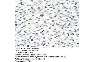 Rabbit Anti-DDX19B Antibody  Paraffin Embedded Tissue: Human Heart Cellular Data: Myocardial cells Antibody Concentration: 4.