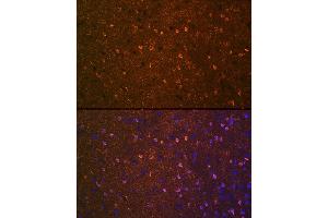 Immunofluorescence analysis of mouse brain using BDNF Rabbit mAb (ABIN7265916) at dilution of 1:100 (40x lens).