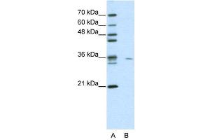 WB Suggested Anti-MDS032  Antibody Titration: 0.