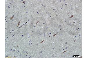 Formalin-fixed and paraffin embedded rat brain tissue labeled with Rabbit Anti-Neuroligin 1 Polyclonal Antibody (ABIN705311) at 1:200 followed by conjugation to the secondary antibody and DAB staining. (Neuroligin 1 anticorps  (AA 701-800))