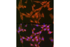 Immunofluorescence analysis of NIH-3T3 cells using LTH Rabbit mAb (ABIN7268244) at dilution of 1:100 (40x lens). (LTA4H anticorps)