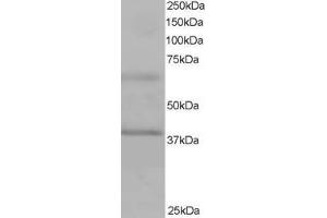 Western Blotting (WB) image for anti-Ankyrin Repeat and BTB (POZ) Domain Containing 1 (ABTB1) (C-Term) antibody (ABIN2465340) (ABTB1 anticorps  (C-Term))