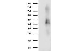 Western Blotting (WB) image for anti-Transmembrane Protein with EGF-Like and Two Follistatin-Like Domains 2 (TMEFF2) antibody (ABIN1501417) (TMEFF2 anticorps)
