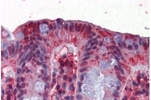 Human Colon (formalin-fixed, paraffin-embedded) stained with GAPDH antibody ABIN351435 at 2. (GAPDH anticorps  (AA 51-100))