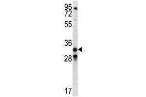 GDF15 antibody western blot analysis in NCI-H460 lysate