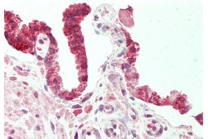 Rabbit Anti-SEC14L2 antibody  Formalin Fixed Paraffin Embedded Tissue: Human Prostate Primary antibody Concentration: 1:100 Secondary Antibody: Donkey anti-Rabbit-Cy3 Secondary Antibody Concentration: 1:200 Magnification: 20x Exposure Time: 0.