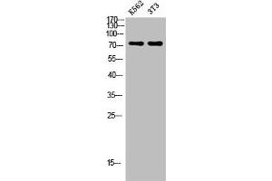 Western blot analysis of K562 3T3 lysate, antibody was diluted at 500. (Endoglin anticorps  (AA 370-430))