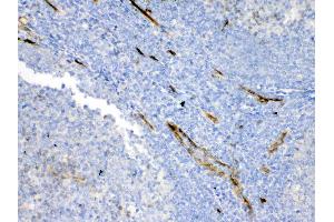 IHC analysis of Bcl-XL using anti-Bcl-XL antibody .