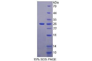 SDS-PAGE analysis of Human ACD Protein. (ACD Protéine)