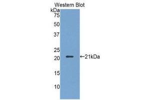 Western Blotting (WB) image for anti-Killer Cell Lectin-Like Receptor Subfamily D, Member 1 (KLRD1) (AA 32-179) antibody (ABIN1859565) (CD94 anticorps  (AA 32-179))